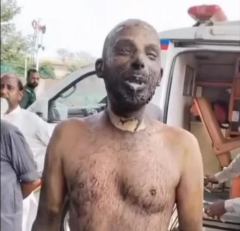 Wazirabad Worker Injured After Setting Himself on Fire, Sources Say