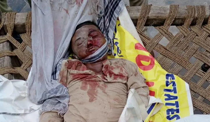 TEENAGE WORKER KILLED IN BUILDING COLLAPSE IN SITARA VALLEY