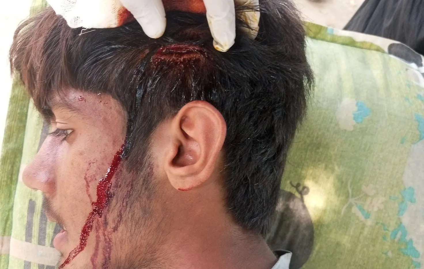 THREE INJURED IN GUNFIRE OVER CROP HARVEST DISPUTE IN TANDLIANWALA