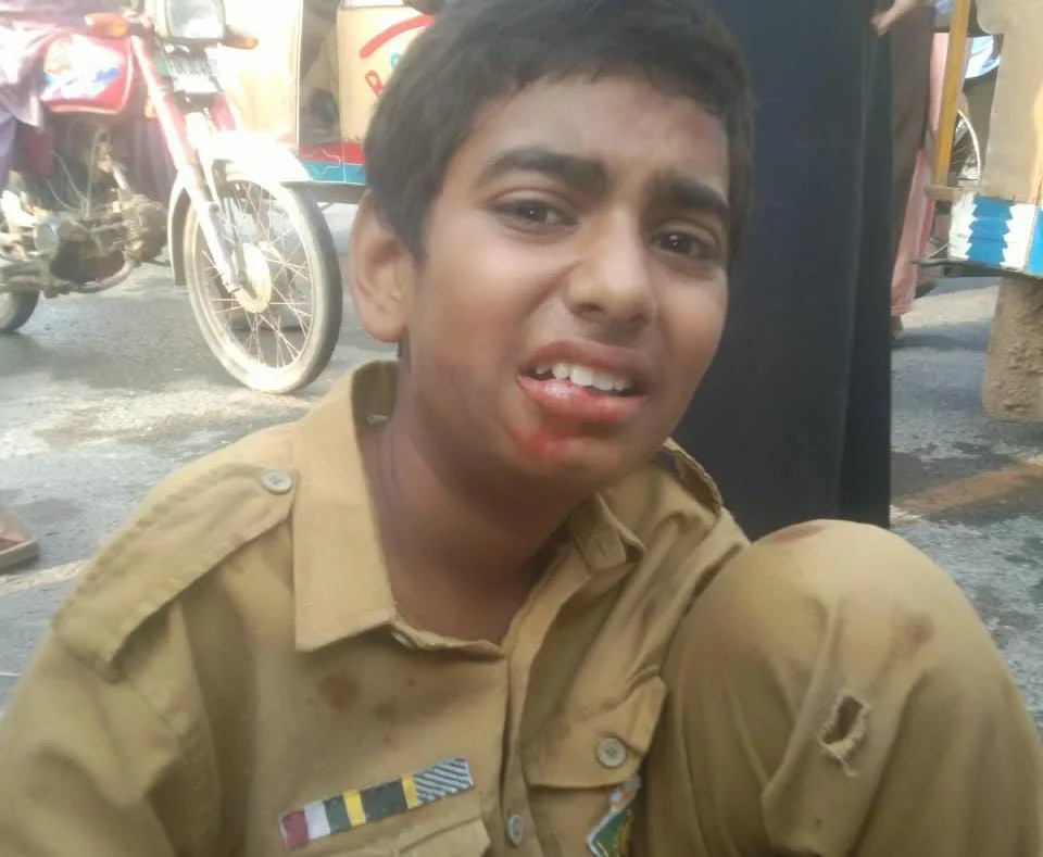 Two Students Injured in Rickshaw Collision Near Chak Jhumra